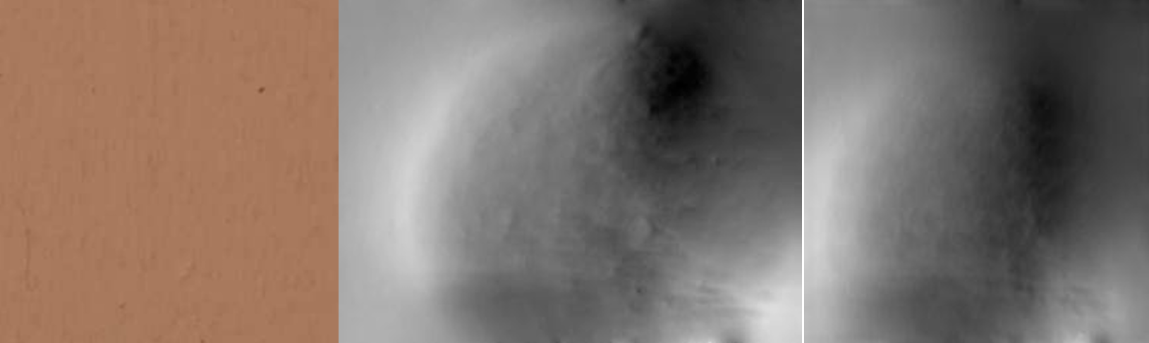 Limitation case example